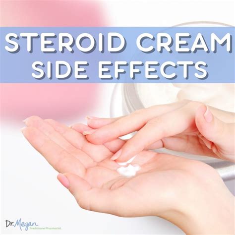 Steroid Cream Side Effects | Dr. Megan