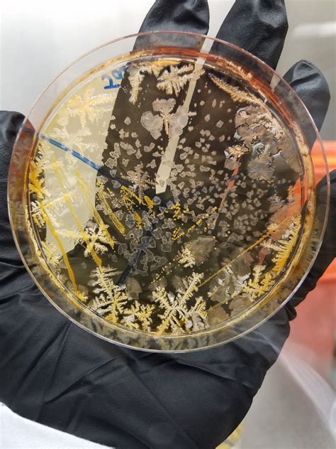 Any idea what this could be? MSA plate. Contaminated with something, honestly asking just out of ...