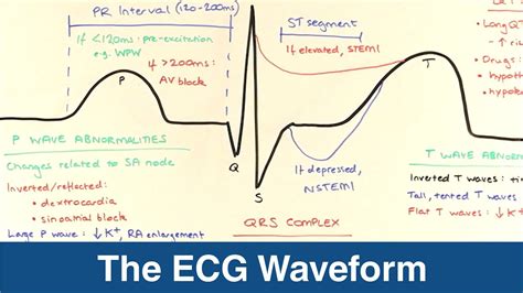 The ECG Waveform (UK/USMLE) | PostGradMedic - YouTube