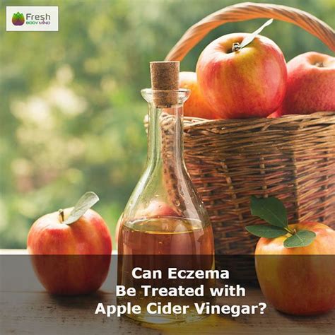 Can Eczema Be Treated with Apple Cider Vinegar? | Fresh Body Mind