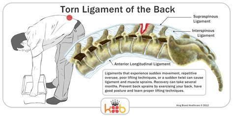 Lower Back Ligaments Anatomy