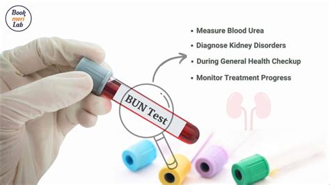 Blood Urea Nitrogen (BUN Test): Price, Purpose & Results [2022]