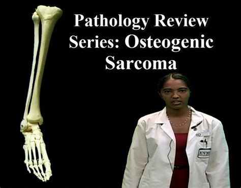 Pathology Review Series: Osteogenic Sarcoma - Anatomy Guy