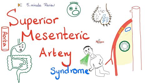 Superior Mesenteric Artery (SMA) Syndrome | Nutcracker Syndrome | Clinically-Oriented Anatomy ...