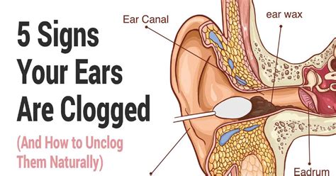 Signs Of Clogged Ears And How To Unclog Them - Kaiser Magazine