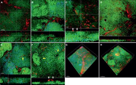 Frontiers | Fusobacterium Species and Subspecies Differentially Affect ...