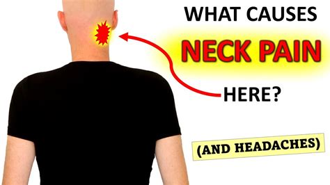 What Causes Upper Neck Pain? (And Headaches!) - YouTube