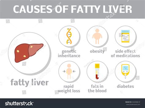 Causes Steatosis Vector Elements Flat Style Stock Vector (Royalty Free ...