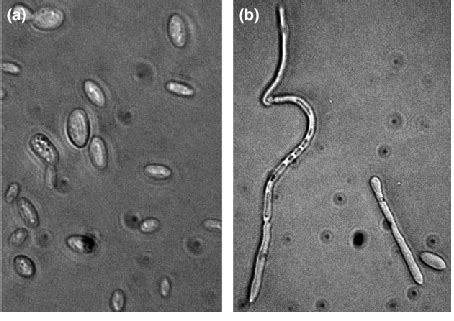 Dimorphism in Brettanomyces bruxellensis cells that were collected for... | Download Scientific ...