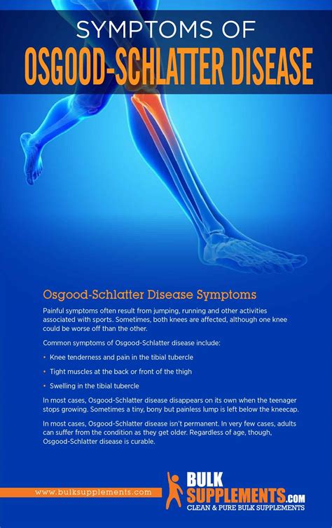 Tablo | Read 'Osgood-Schlatter Disease: Symptoms, Causes & Treatment' by