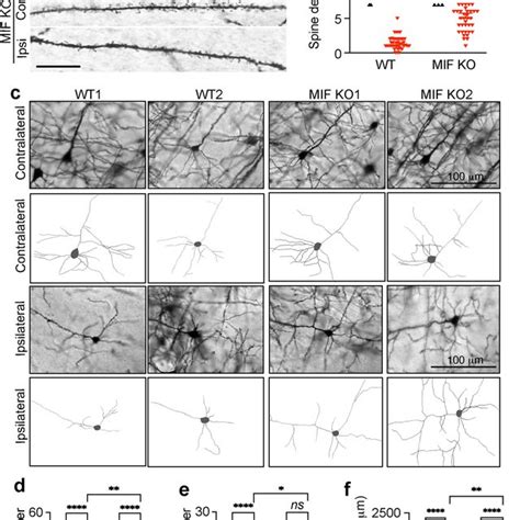 Characterization of dendritic spine density and neuronal morphology in ...