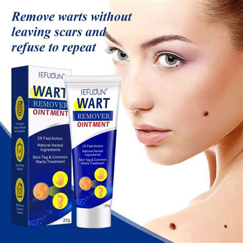 Wart Removal Cream Ubat buang kutil ketuat tahi lalat biji kolestrol Mole Removal Wart Cream ...