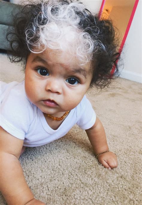 This Baby Was Born With the Same White Hair Streak as Her Mom | Allure