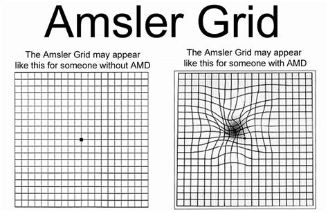 Amsler Grid - EyeSight