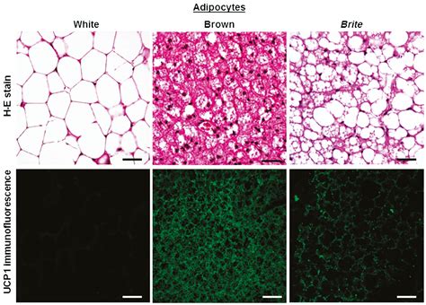 Brown Adipose Connective Tissue