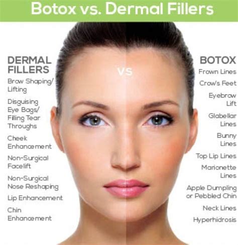 The difference between Botox & Fillers Botox contains purified bacteria ...