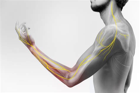 Stellate Ganglion Block | Excel Pain and Spine