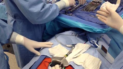 Cesarean section surgery (practice) - YouTube