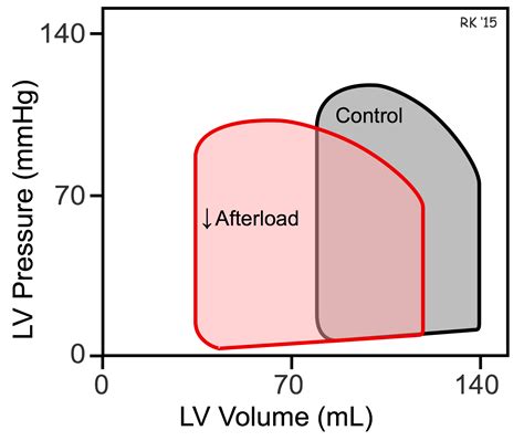 CV Physiology | Cardiac Afterload