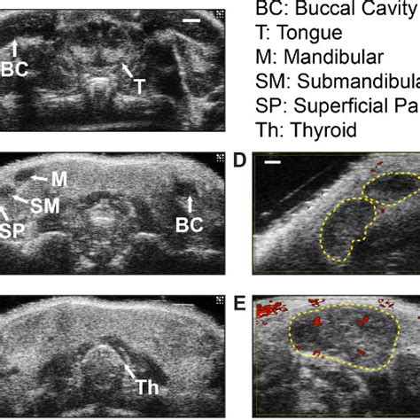 Cervical lymph node biopsy set-up, imaging and cytospin analysis of... | Download Scientific Diagram