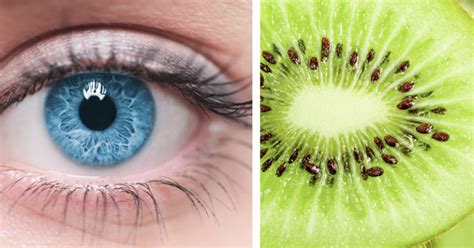 Kiwi Health Benefits: 10 Uses For This Tasty & Refreshing Fruit