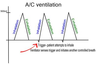 AC versus SIMV mode. - Critical Care Practitioner