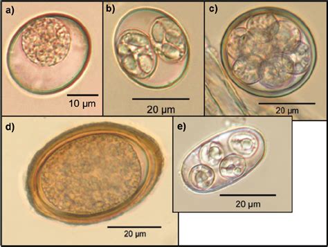 Coccidia oocysts: Cystoisospora species (a, b), coccidia oocyst with ...