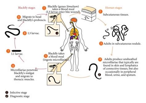 Life cycle of Onchocerca volvulus [8]. | Download Scientific Diagram