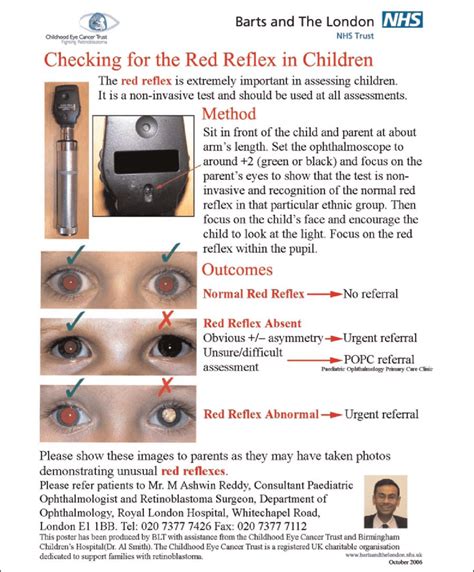 Abnormal red reflex information poster | Download Scientific Diagram