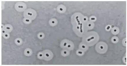 Bacterial Capsule Stain