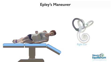 Epley Maneuver To Treat Bppv Vertigo Vertigodizzy Epley Maneuver | Images and Photos finder
