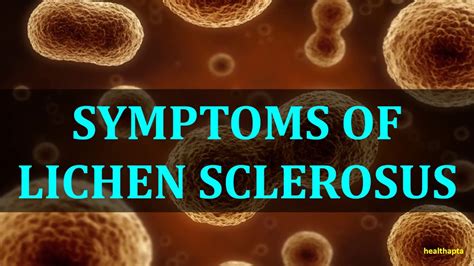 SYMPTOMS OF LICHEN SCLEROSUS - YouTube