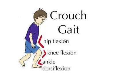 What is Crouch Gait