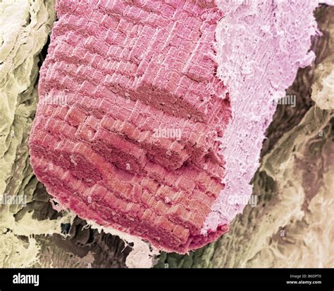 Skeletal Muscle Tissue Micrograph