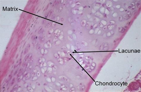 Lacunae Cartilage