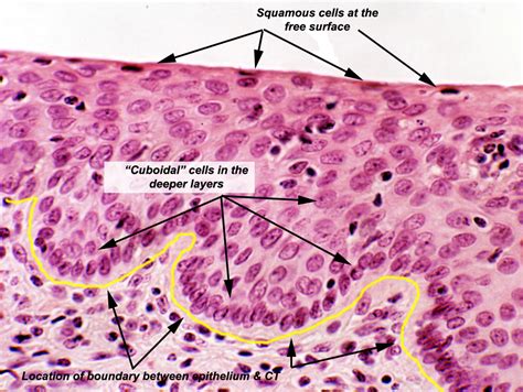 Medical School • Stratified squamous epithelium