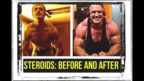 Steroid Transformation Before and After - YouTube