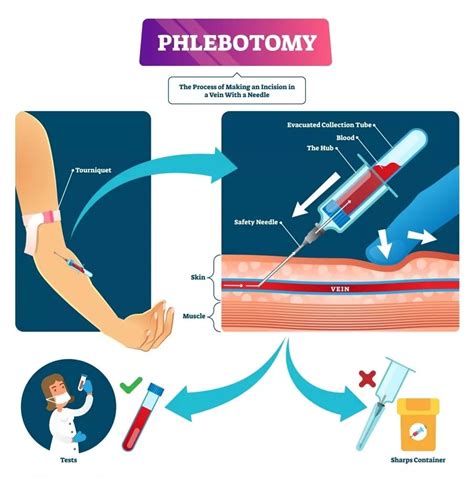 How To Anchor A Vein Phlebotomy - E Phlebotomy Training