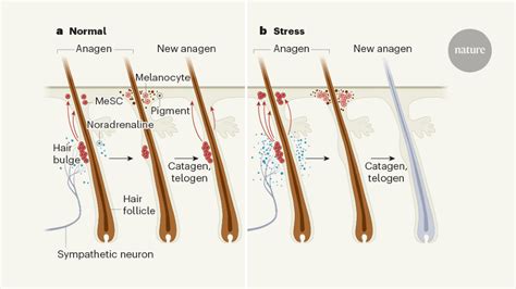 What Causes White Hair In Humans - White Hair Causes How To Stop White ...