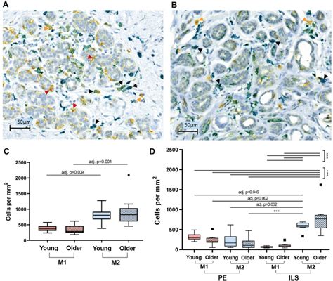 M1 and M2 macrophage quantification in IHC-stained breast tissue ...