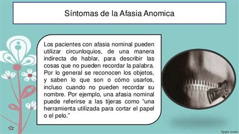 Afasia anómica