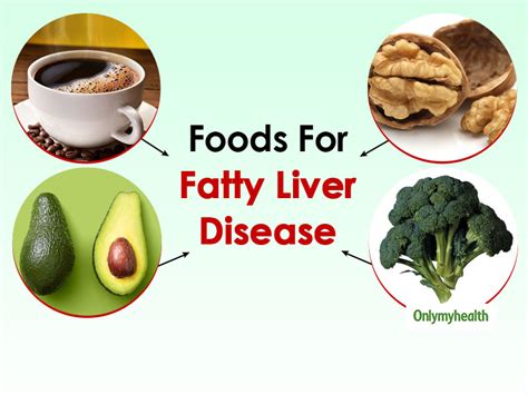 Do You Have Fatty Liver Disease? You Must Try Fatty Liver Diet | OnlyMyHealth