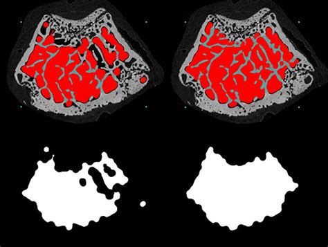 Bone Morphometry in Micro-CT: Separating Trabecular and Cortical Bone | Blue Scientific