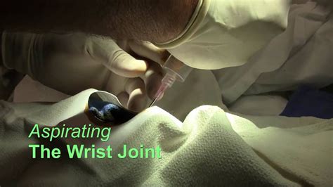 Wrist Joint Arthrocentesis - YouTube