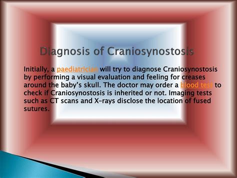 PPT - Craniosynostosis: Types, Causes, Symptoms, Diagnosis and Treatment PowerPoint Presentation ...