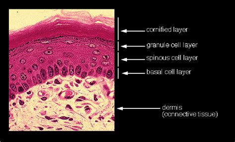 1: Keratinization process of skin | Download Scientific Diagram