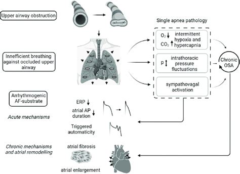 Pathogenesis of atrial arrhythmia in obstructive sleep apnea ...