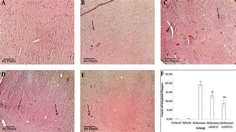 Brain histology after Congo Red staining. Staining the Congo Red was... | Download Scientific ...