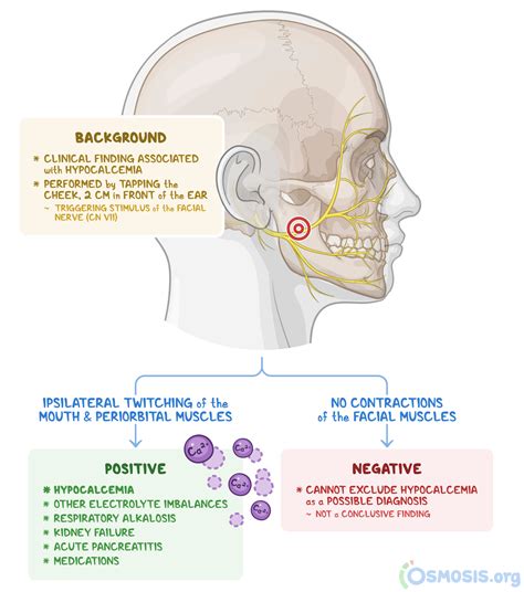 Chvostek Sign: What Is It, What Does It Indicate | Osmosis