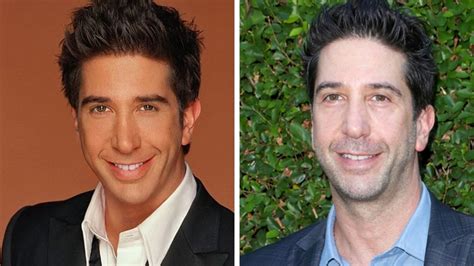 'Friends' Star David Schwimmer's Plastic Surgery - Did He Go Under the ...